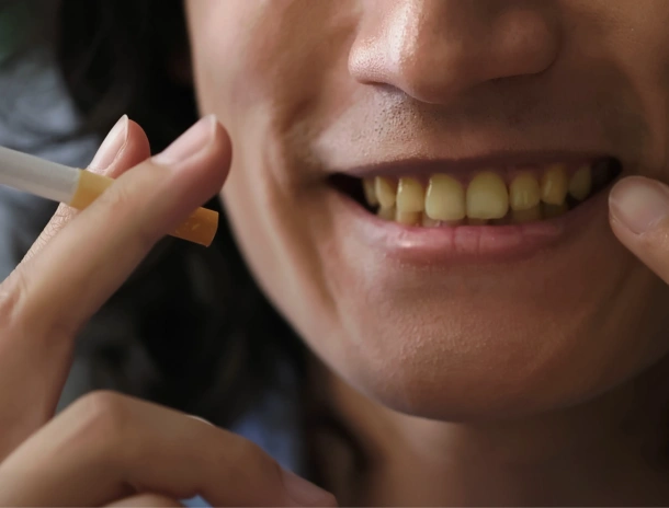 Person smiling broadly, pointing to teeth, demonstrating dental health and satisfaction with dental care.