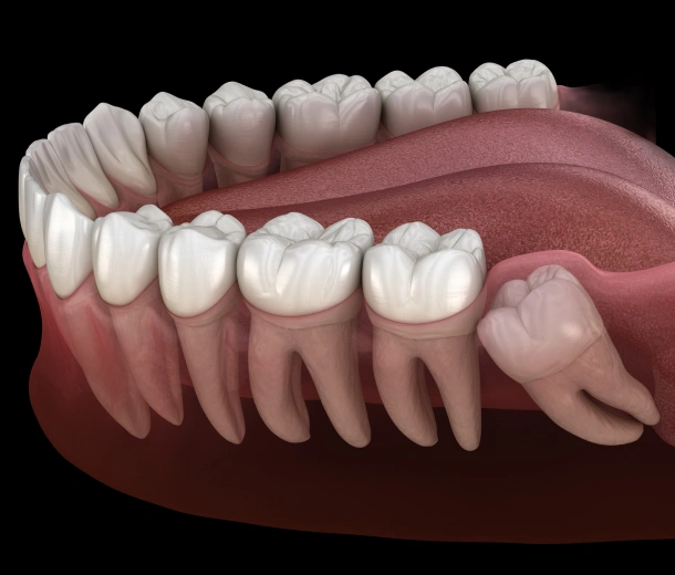 3D dental illustration showing complete set of upper and lower teeth with gum anatomy